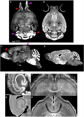 Restoring morphology of light sheet microscopy data based on magnetic resonance histology